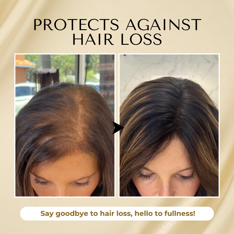 Timilk® VitaStrand Biotin Hair Growth Spray