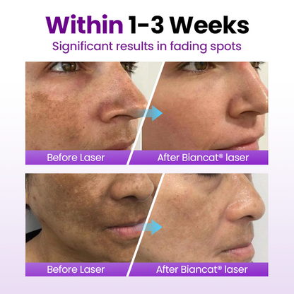 Biancat® SpotErase Probiotic Shield Serum