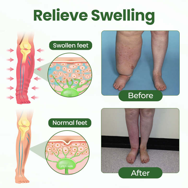 Timilk® BodyRelief Circulation Cream — 48-Hour Visible Swelling Relief