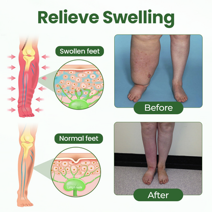 Timilk® BodyRelief Circulation Cream — 48-Hour Visible Swelling Relief