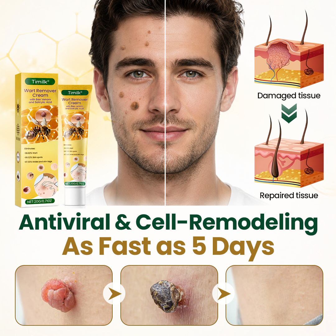 Timilk® Wart Remover Cream with Bee Venom and Salicylic Acid – Skin Tag Removal & Skin Repair Formula for Face and Body