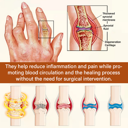 Timilk® VenomEase Joint Cream