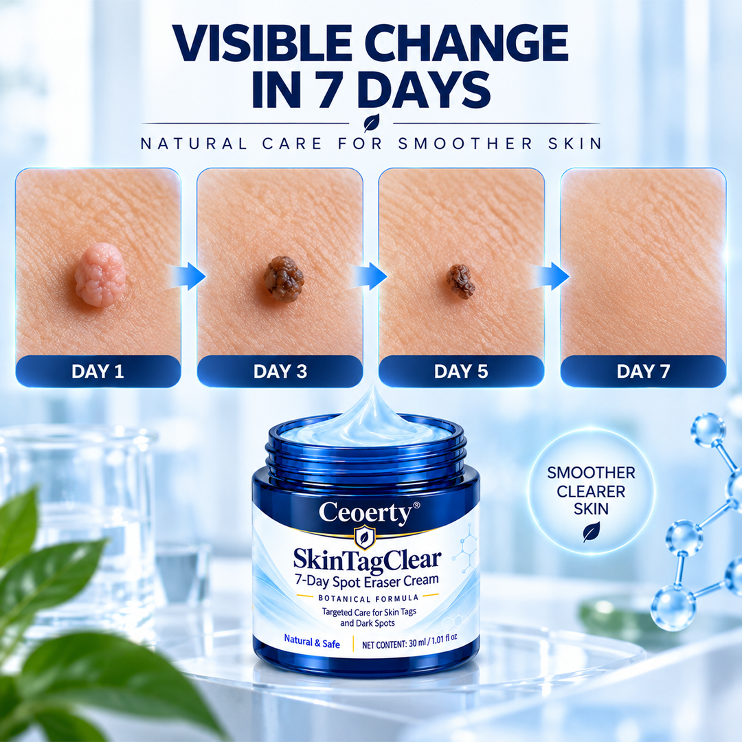 Ceoerty® SkinTagClear 7-Day Spot Eraser Cream-