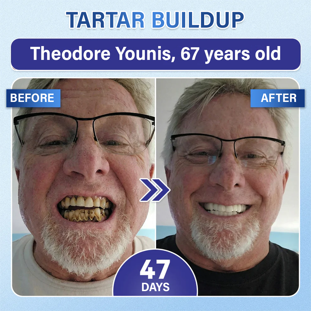 Your Smile🦷Ceoerty® Tooth & Gum Repair Fast-Dissolving Microneedle Patch✨ (𝟓-𝐢𝐧-𝟏 💎 𝐑𝐞𝐛𝐮𝐢𝐥𝐝 𝐄𝐧𝐚𝐦𝐞𝐥 & 𝐃𝐞𝐧𝐭𝐢𝐧 • 𝐒𝐭𝐫𝐞𝐧𝐠𝐭𝐡𝐞𝐧 𝐆𝐮𝐦𝐬 • 𝐄𝐫𝐚𝐝𝐢𝐜𝐚𝐭𝐞 𝐓𝐚𝐫𝐭𝐚𝐫 & 𝐎𝐝𝐨𝐫 • 𝐖𝐡𝐢𝐭𝐞𝐧𝐢𝐧𝐠 • 𝐒𝐭𝐨𝐩 𝐓𝐨𝐨𝐭𝐡 𝐒𝐞𝐧𝐬𝐢𝐭𝐢𝐯𝐢𝐭𝐲)