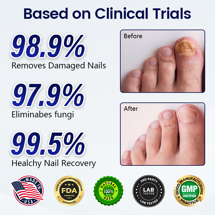 Timilk® Anti-Fungal Nail Repair Patch