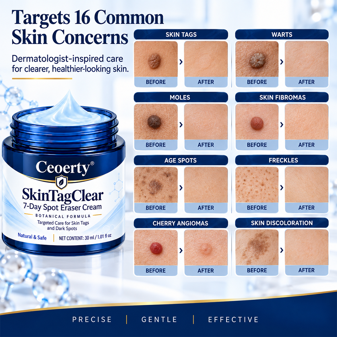 Ceoerty® SkinTagClear 7-Day Spot Eraser Cream-