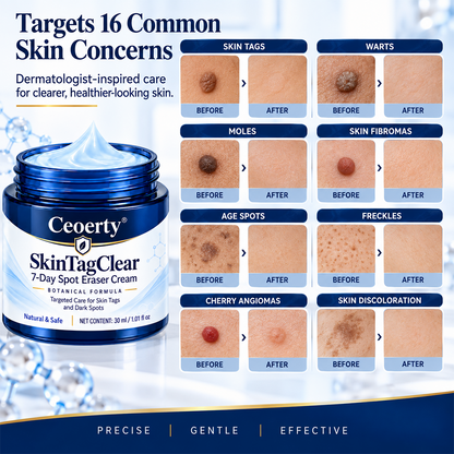 Ceoerty® SkinTagClear 7-Day Spot Eraser Cream-
