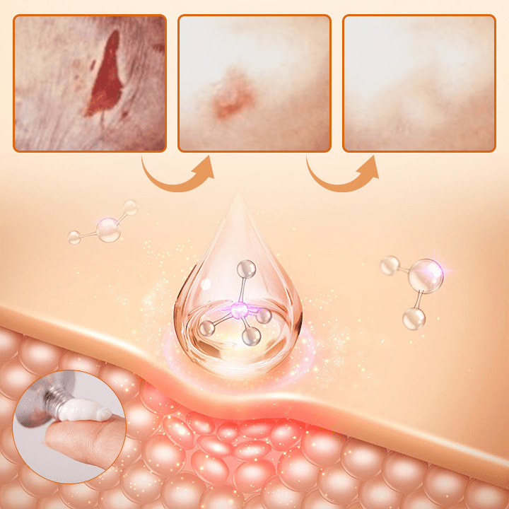 Ceoerty™ Diabetes Wound Strong Treatment Cream English CLJL 