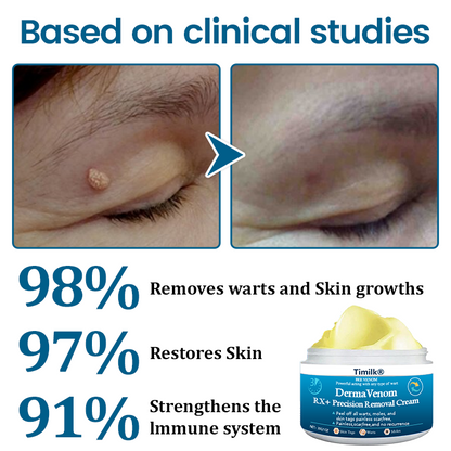 Timilk® DermaVenom RX+ Precision Removal Cream