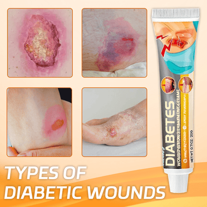 Ceoerty™ Diabetes Wound Strong Treatment Cream English CLJL 
