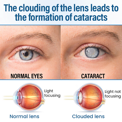 Timilk® VisionReborn Nano Eye Drops — 🌿Nano Actives,  Vision Without Surgery