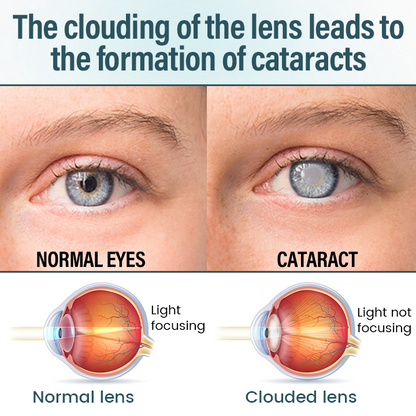 Timilk® OptiFusion Nano Eye Drops Serum—Nano Technology Restores Clear Vision,  No Glasses, No Surgery