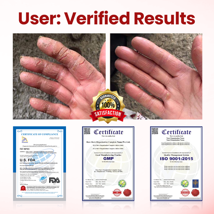 Timilk® VitaGluco Diabetic Care Cream