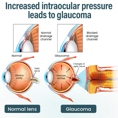 Timilk® OptiFusion Nano Eye Drops Serum—Nano Technology Restores Clear Vision,  No Glasses, No Surgery