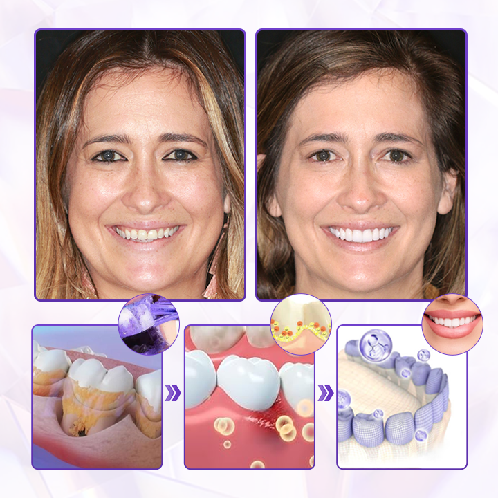 Biancat® BeeRenew Advanced Gum Healing Toothpaste