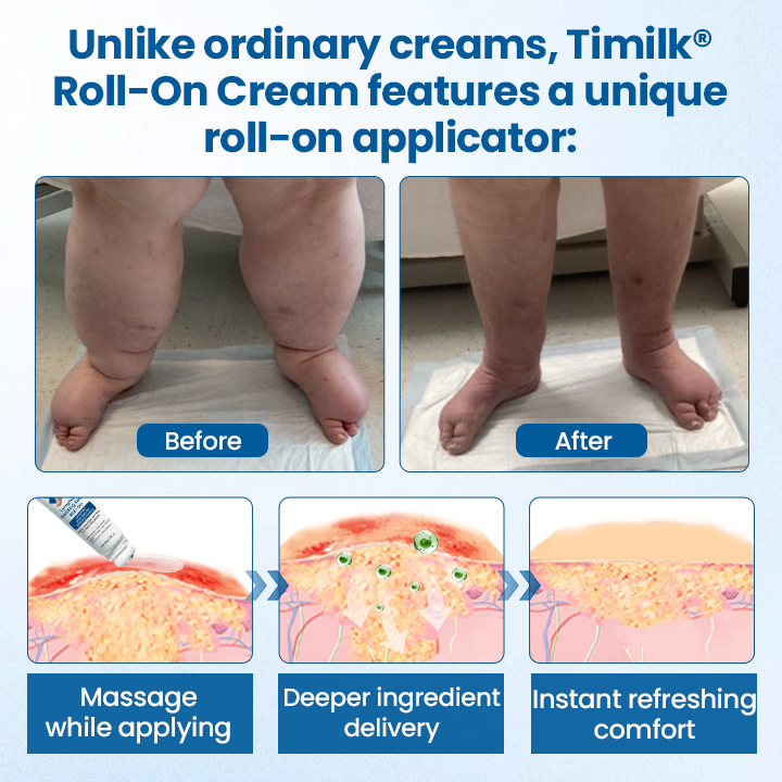 Timilk® Lymphora Swelling Relief Roll-On
