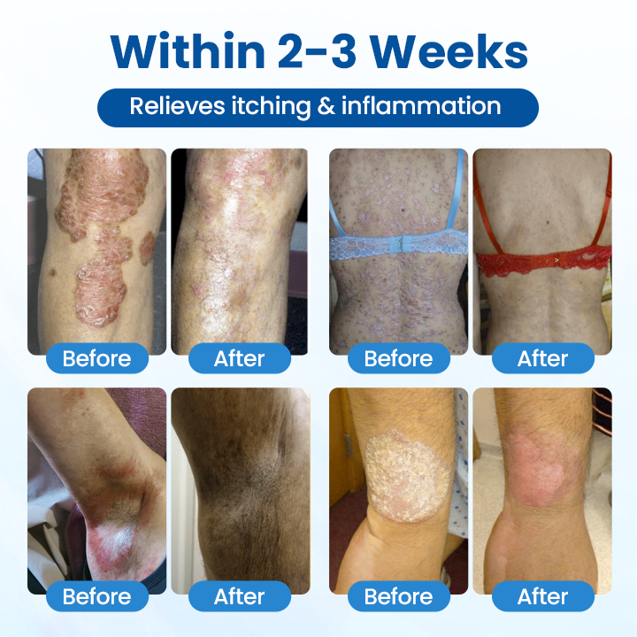 Timilk® PCA Magnesium Deep Repair Spray