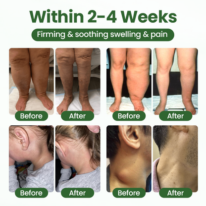 Timilk® BodyRelief Circulation Cream — 48-Hour Visible Swelling Relief