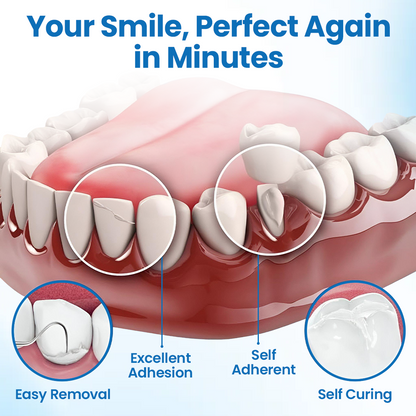 Timilk® SmileMend Tooth Repair Filling Kit