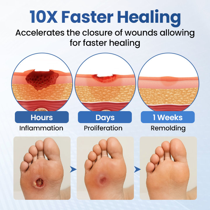 Timilk® GlucoDerm Barrier Spray -