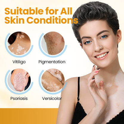 Timilk® VitiGone Rapid Spray — 2–3 Week Repigmentation with OTDS